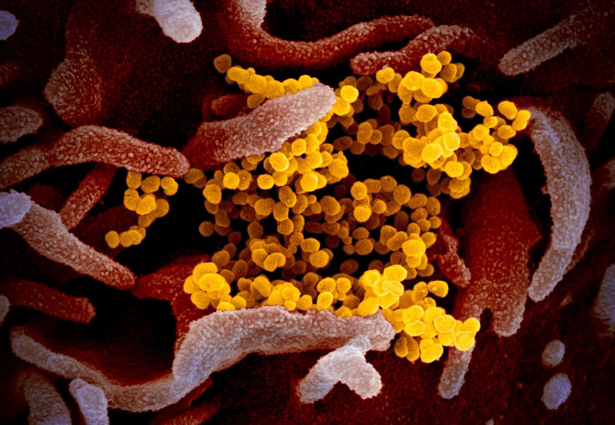 global-biodefense-sars-cov-2-covid-19-niaid-5.jpg